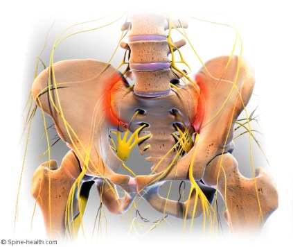 sacroiliac-joint-pain